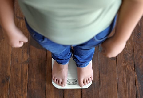 childhood-obesity-blog